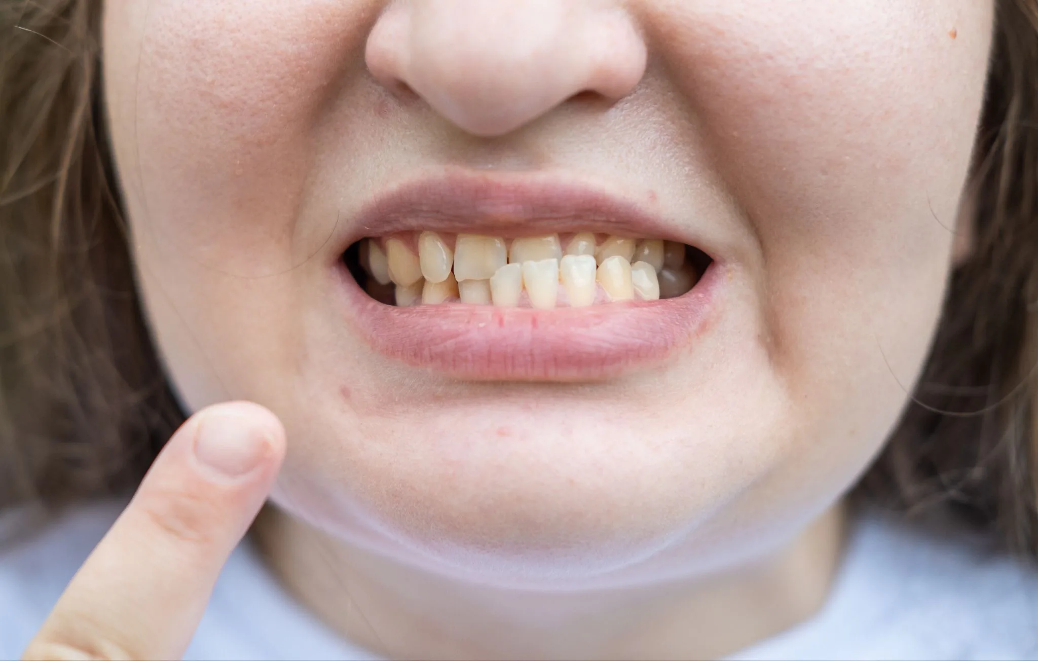 Why your bite matters for posture, breathing and gait after photo