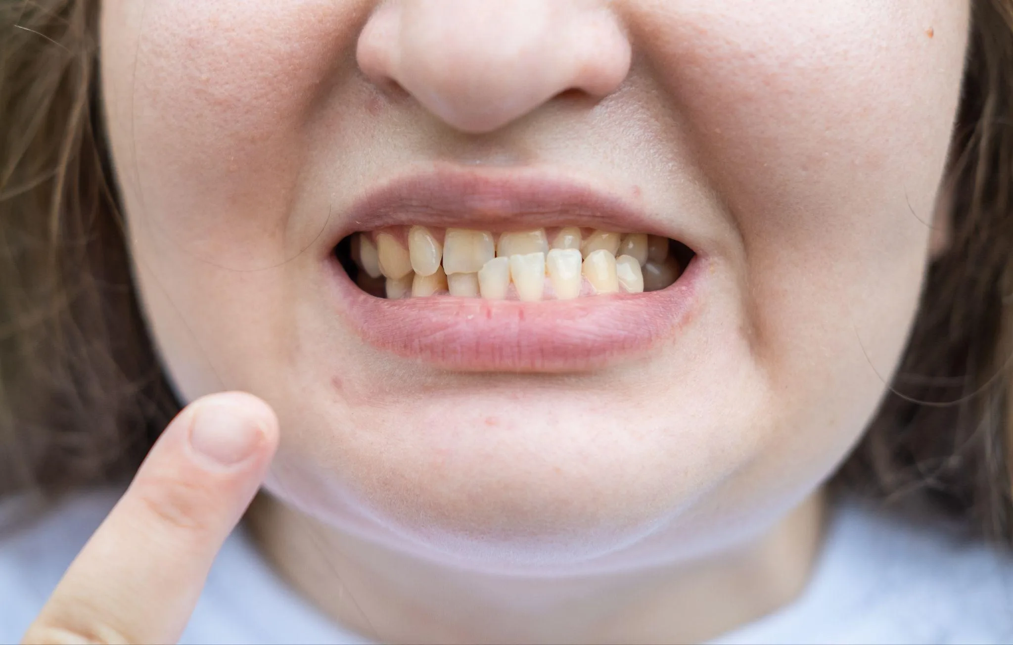 Why Your Bite Matters for Posture, Breathing and Gait after photo