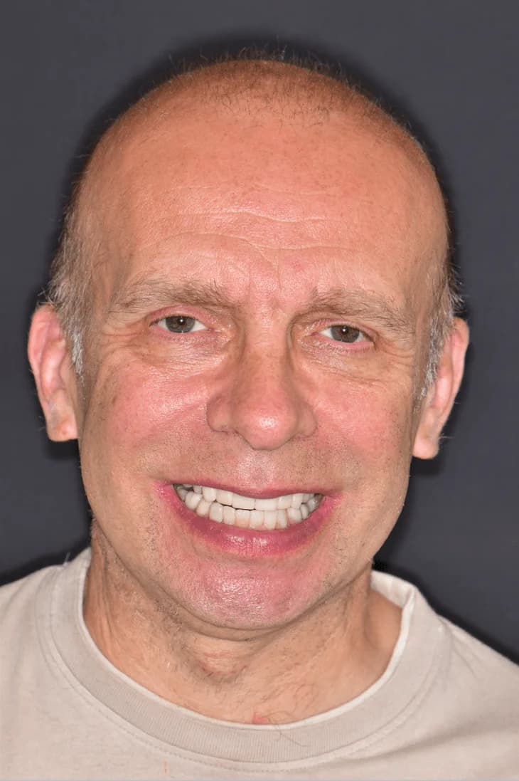After treatment photo