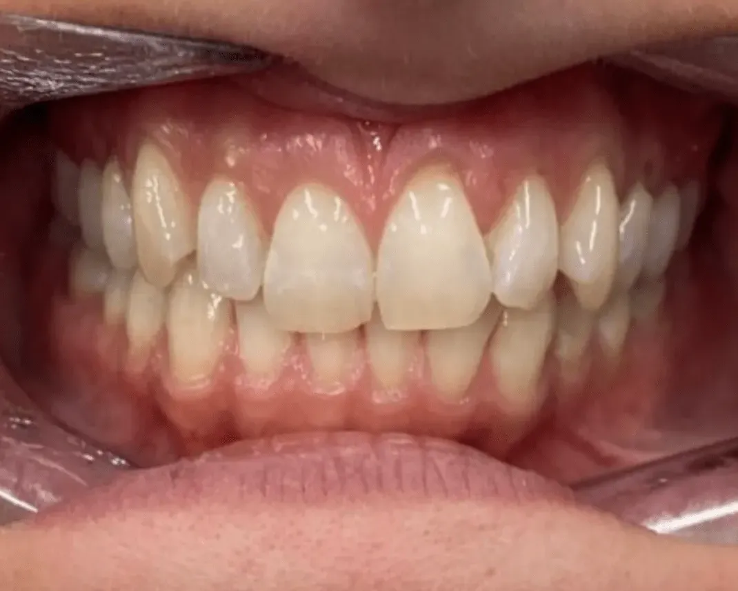 Before treatment photo