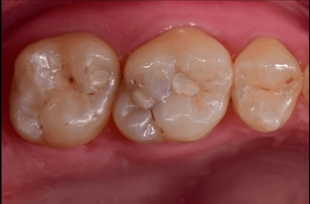 Before treatment photo