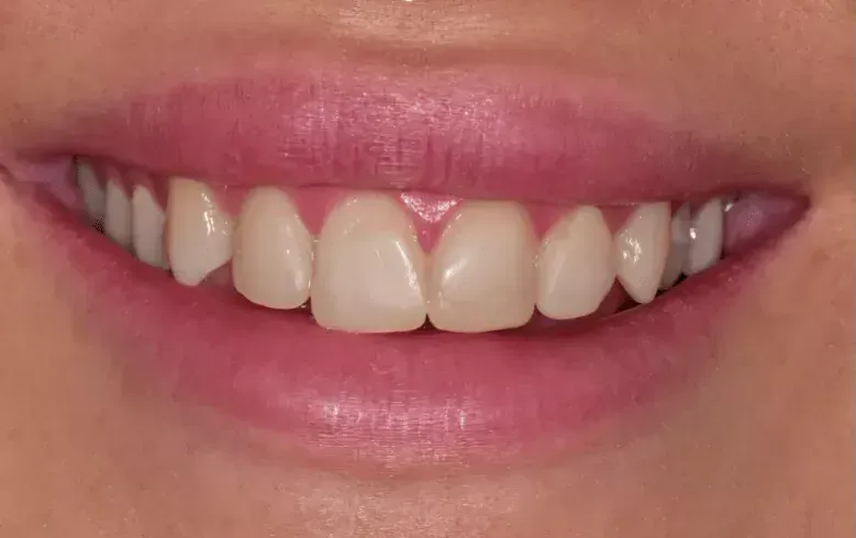 Before treatment photo