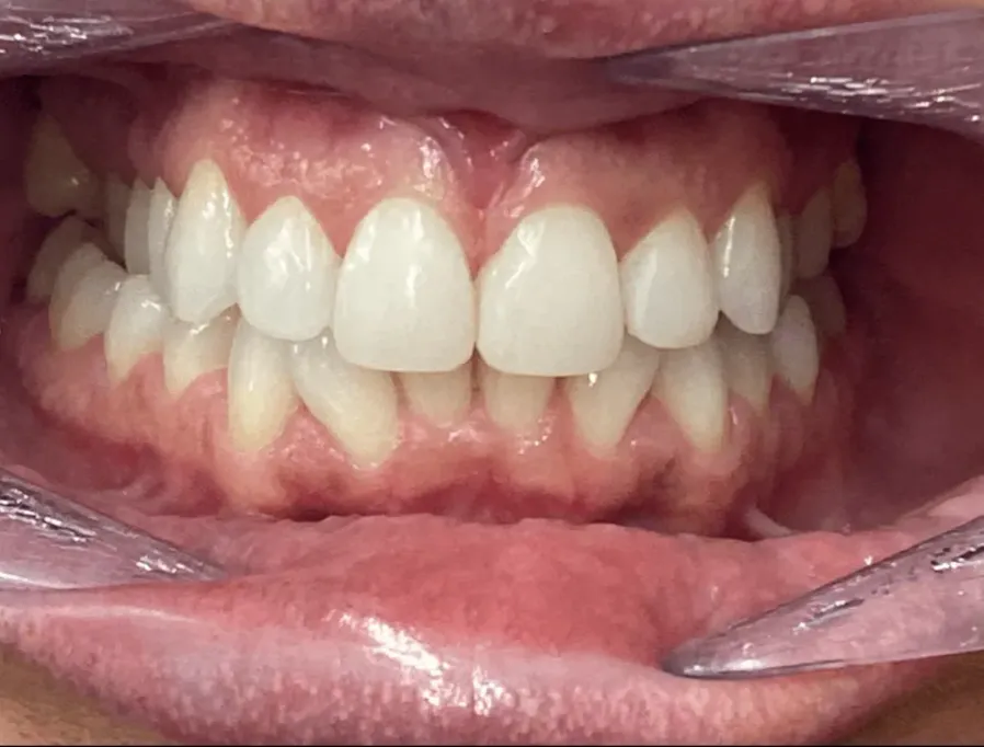 After treatment photo