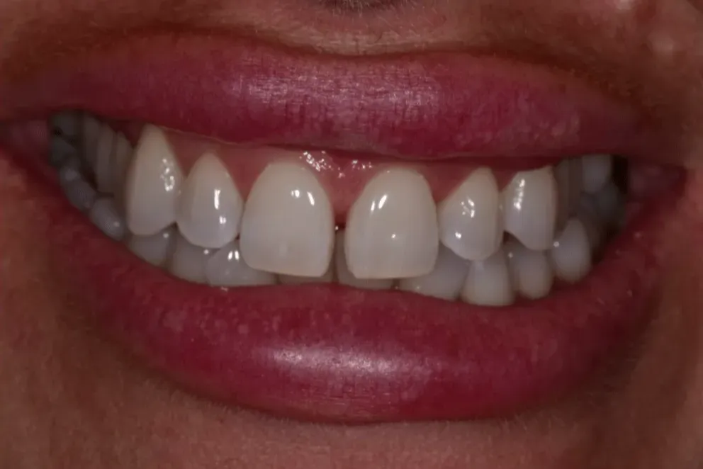 Before treatment photo