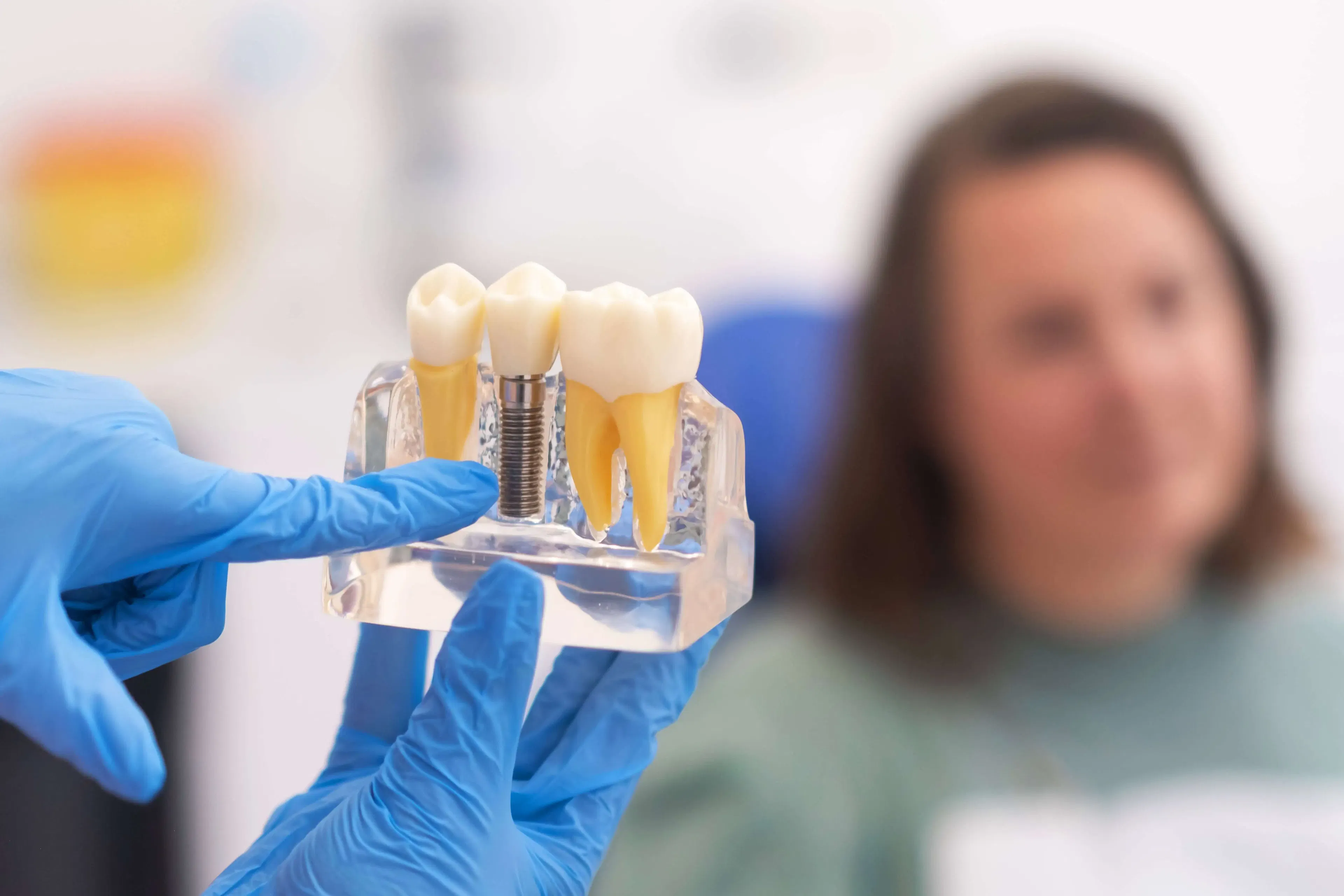 Dental Implants in Norwich preview